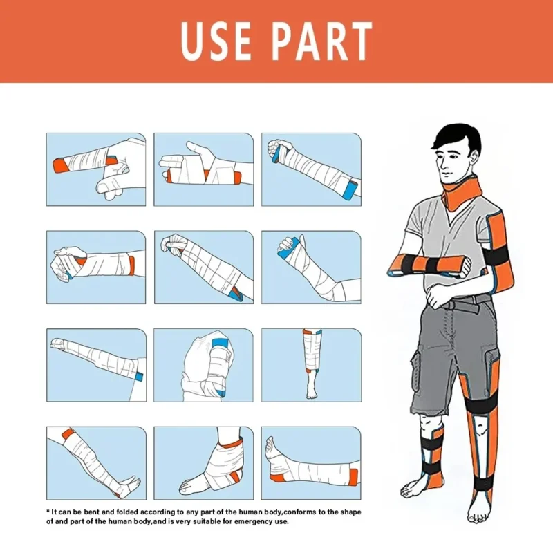 Universal Aluminum Splint Roll - Image 4